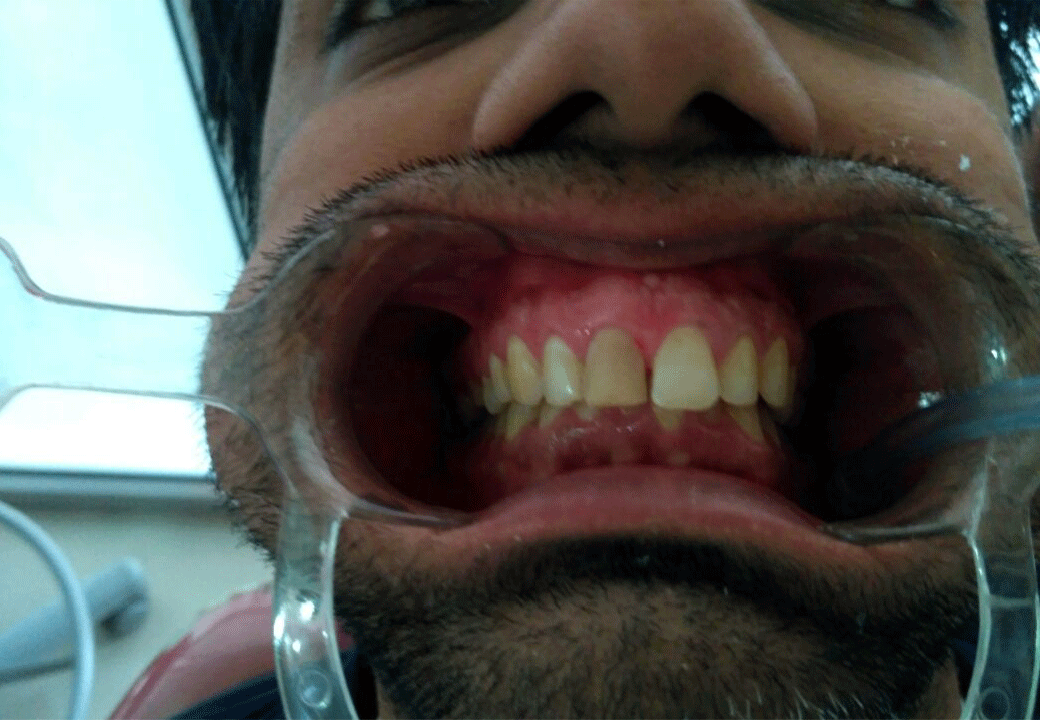 Dental Aesthetics