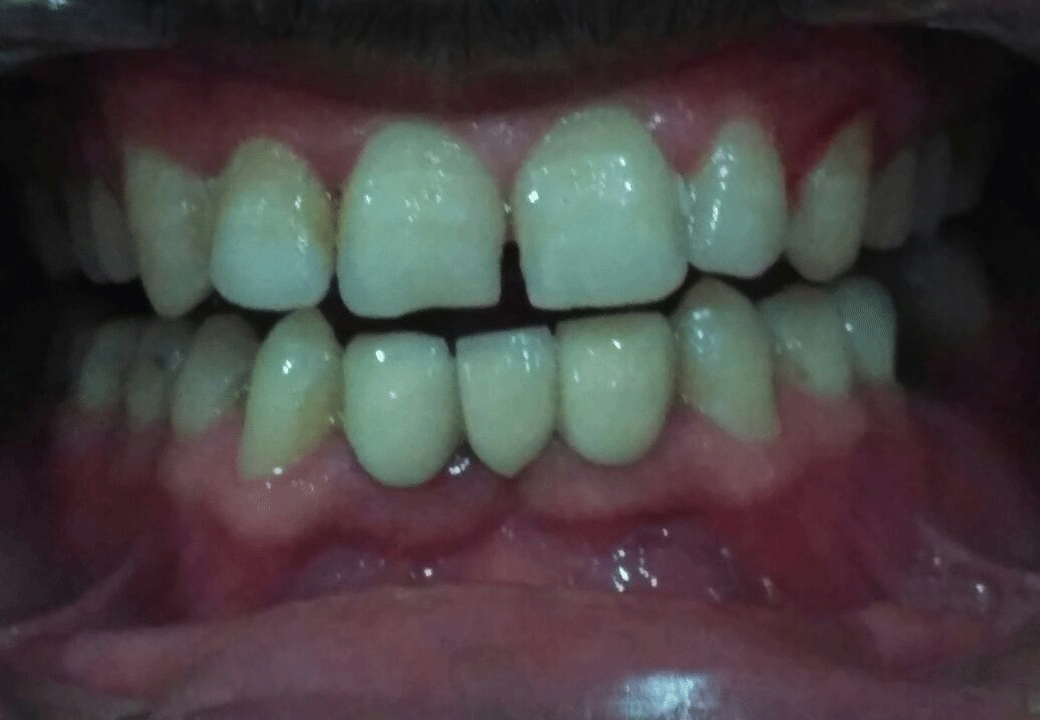 Dental Aesthetics