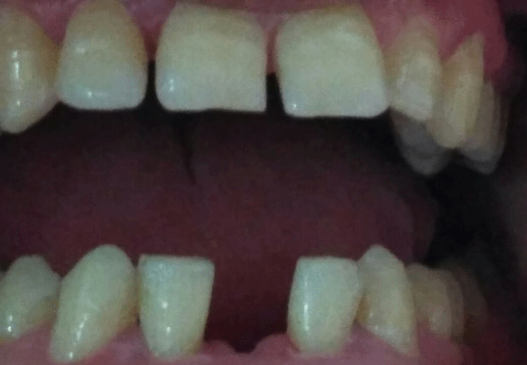 Dental Aesthetics