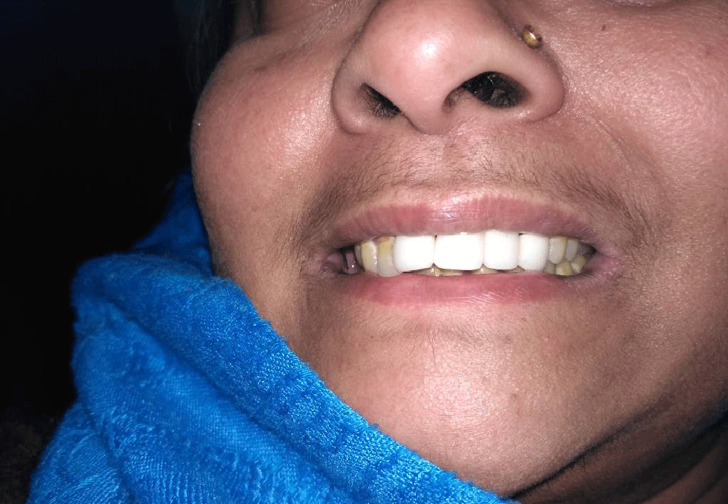 Dental Aesthetics