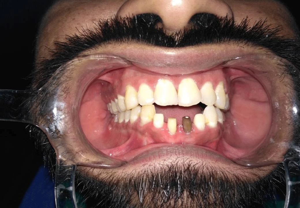Dental Aesthetics