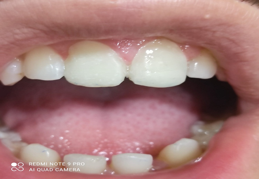 Dental Aesthetics