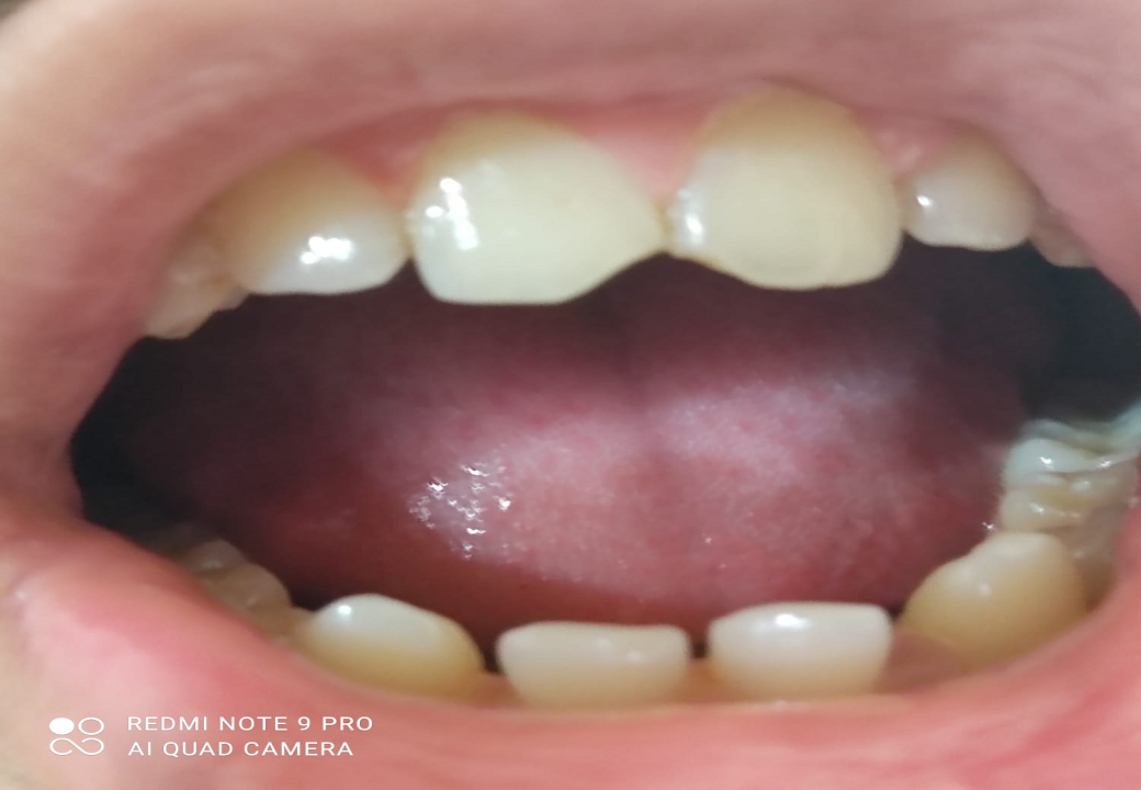 Dental Aesthetics