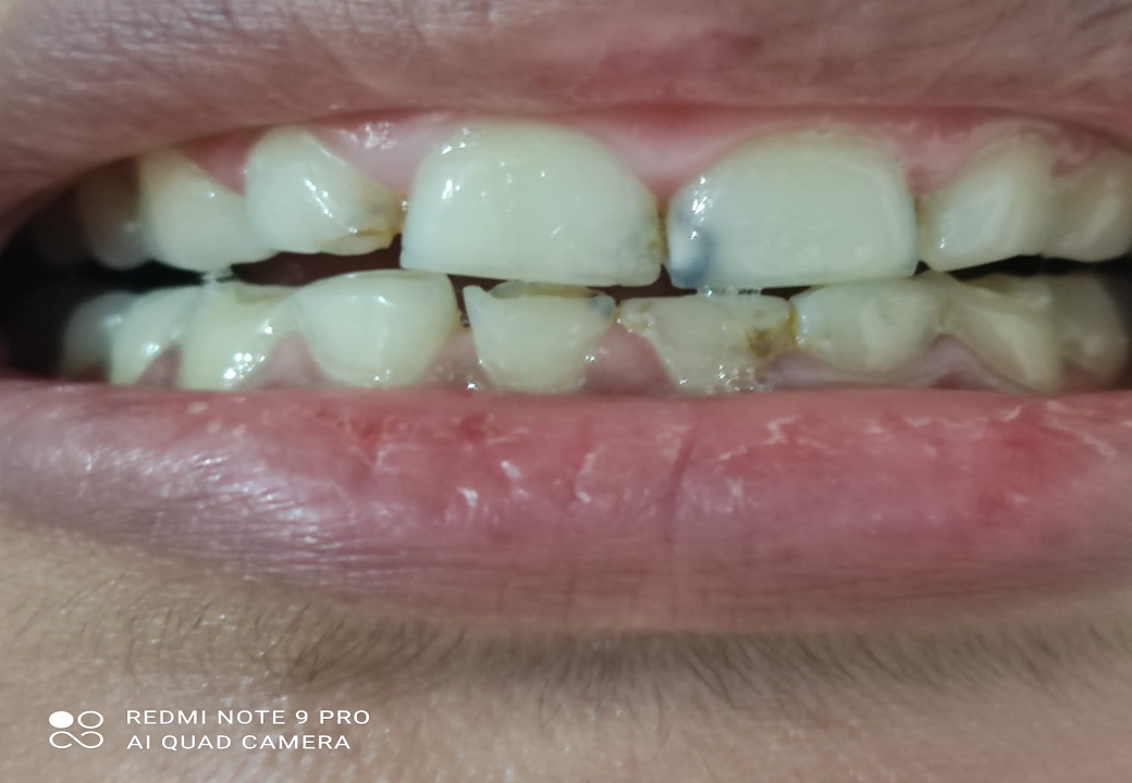 Dental Aesthetics