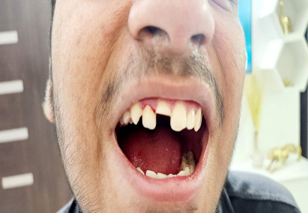 Dental Aesthetics